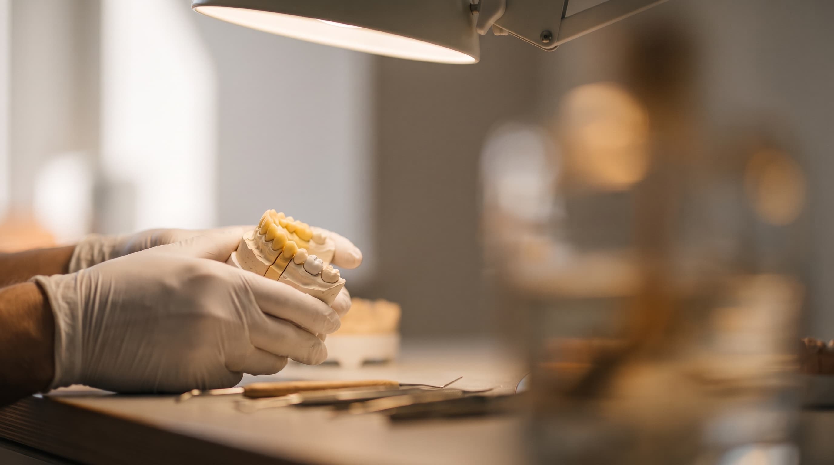 Digitale Planung vor der Veneers-Behandlung